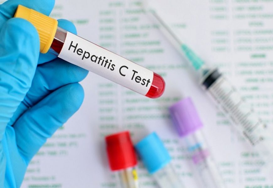 Analize gratuite pentru hepatita C